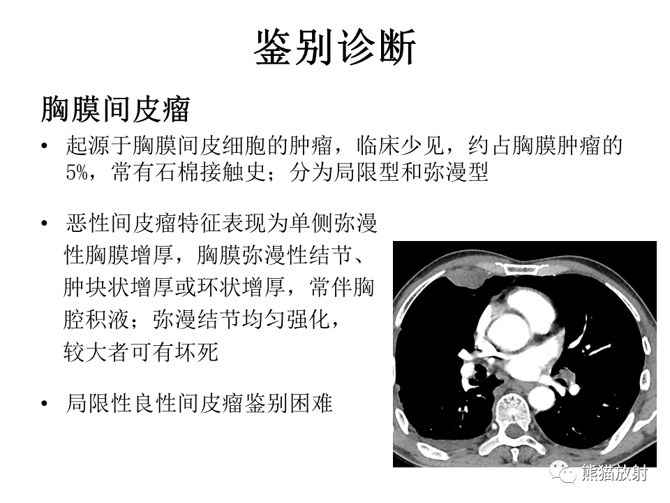 影像PPT - 【病例】胸膜孤立性纤维瘤 VS 胸壁神经鞘瘤-23