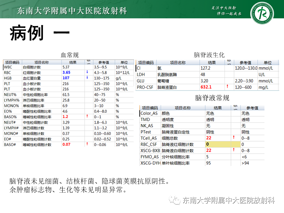 影像PPT - 【PPT】颅内多发环形强化的诊断思路-16 影像PPT - 【PPT】颅内多发环形强化的诊断思路-16
