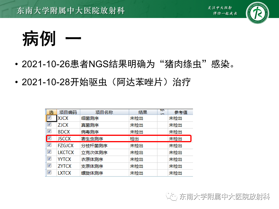 影像PPT - 【PPT】颅内多发环形强化的诊断思路-18 影像PPT - 【PPT】颅内多发环形强化的诊断思路-18