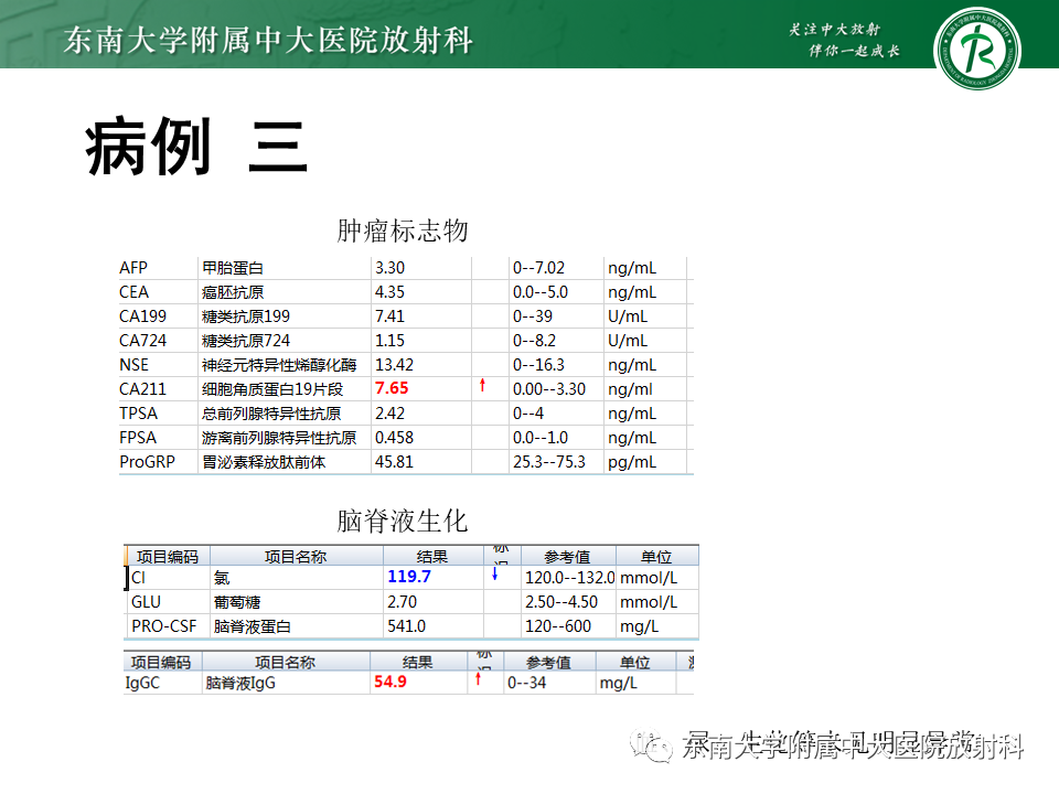 影像PPT - 【PPT】颅内多发环形强化的诊断思路-22 影像PPT - 【PPT】颅内多发环形强化的诊断思路-22