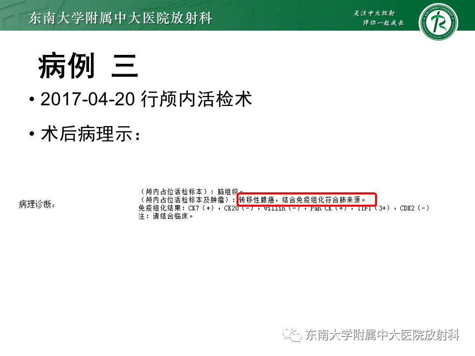 影像PPT - 【PPT】颅内多发环形强化的诊断思路-23 影像PPT - 【PPT】颅内多发环形强化的诊断思路-23