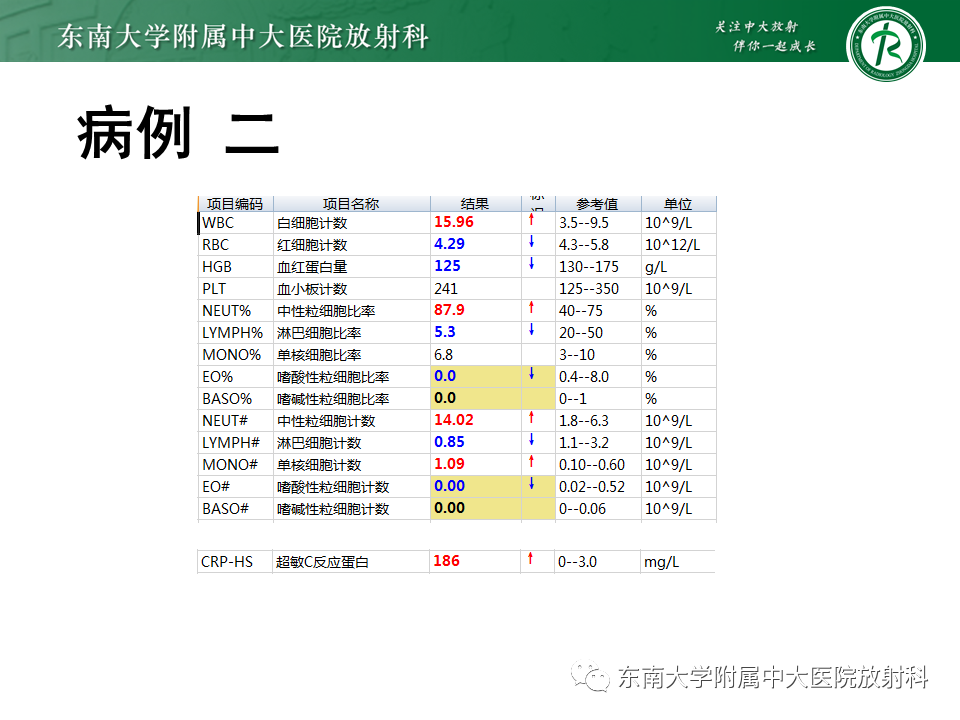 影像PPT - 【PPT】颅内多发环形强化的诊断思路-20 影像PPT - 【PPT】颅内多发环形强化的诊断思路-20