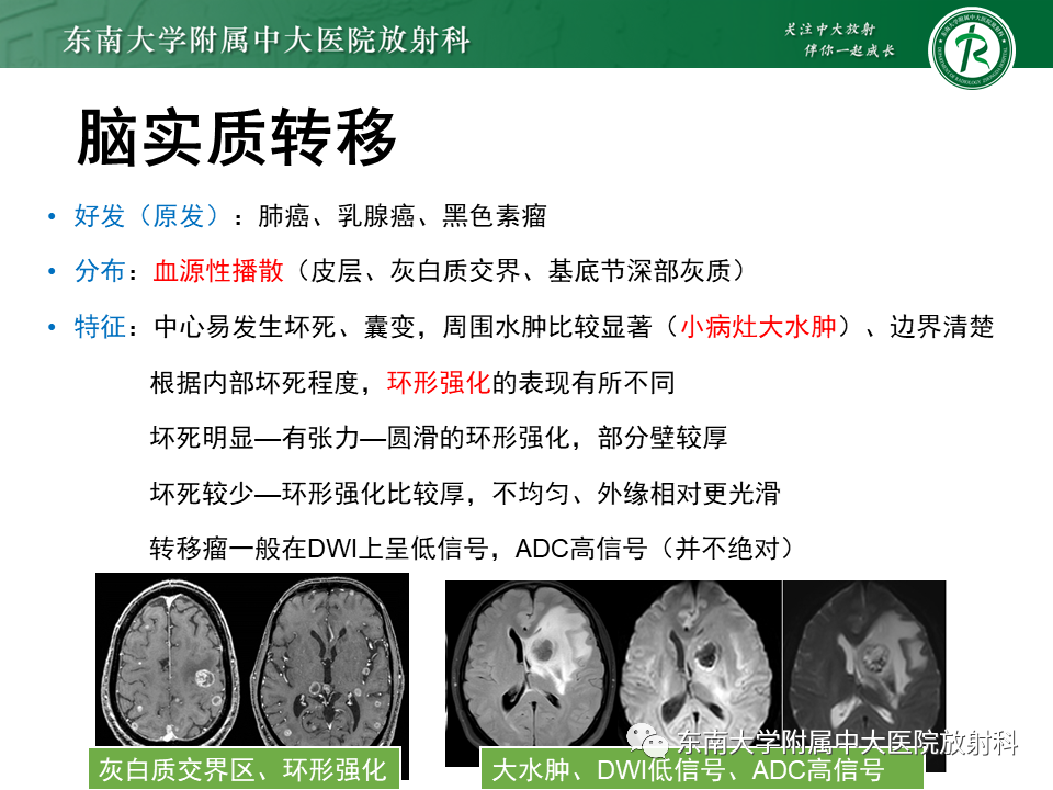 影像PPT - 【PPT】颅内多发环形强化的诊断思路-32 影像PPT - 【PPT】颅内多发环形强化的诊断思路-32