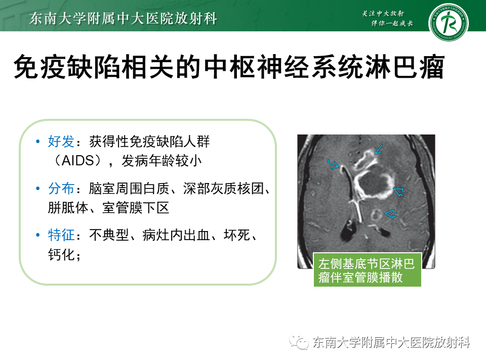影像PPT - 【PPT】颅内多发环形强化的诊断思路-48 影像PPT - 【PPT】颅内多发环形强化的诊断思路-48