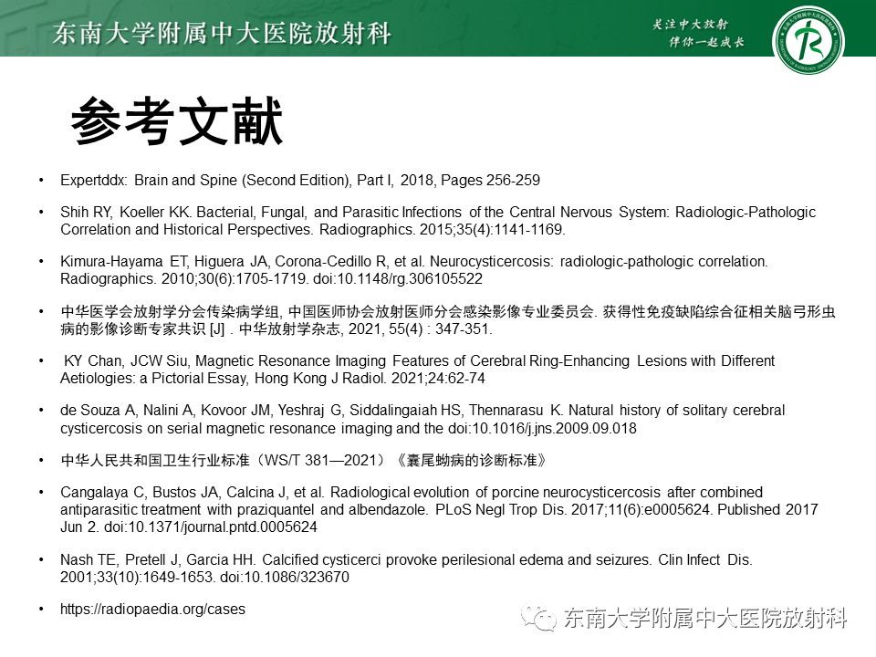 影像PPT - 【PPT】颅内多发环形强化的诊断思路-52 影像PPT - 【PPT】颅内多发环形强化的诊断思路-52