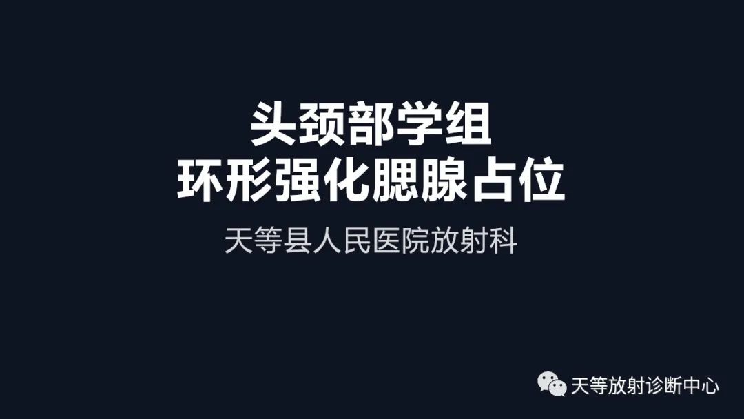 影像PPT - 【病例】环形强化腮腺占位—淋巴上皮囊肿1例-1 影像PPT - 【病例】环形强化腮腺占位—淋巴上皮囊肿1例-1