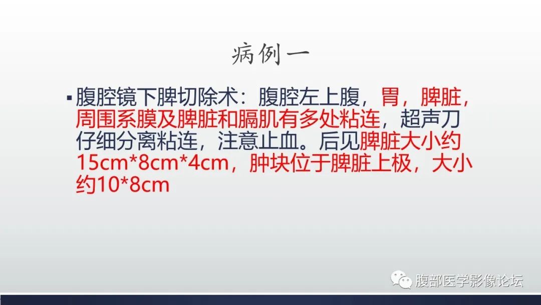 影像PPT - 【病例】脾脏窦岸细胞血管瘤2例影像诊断-17