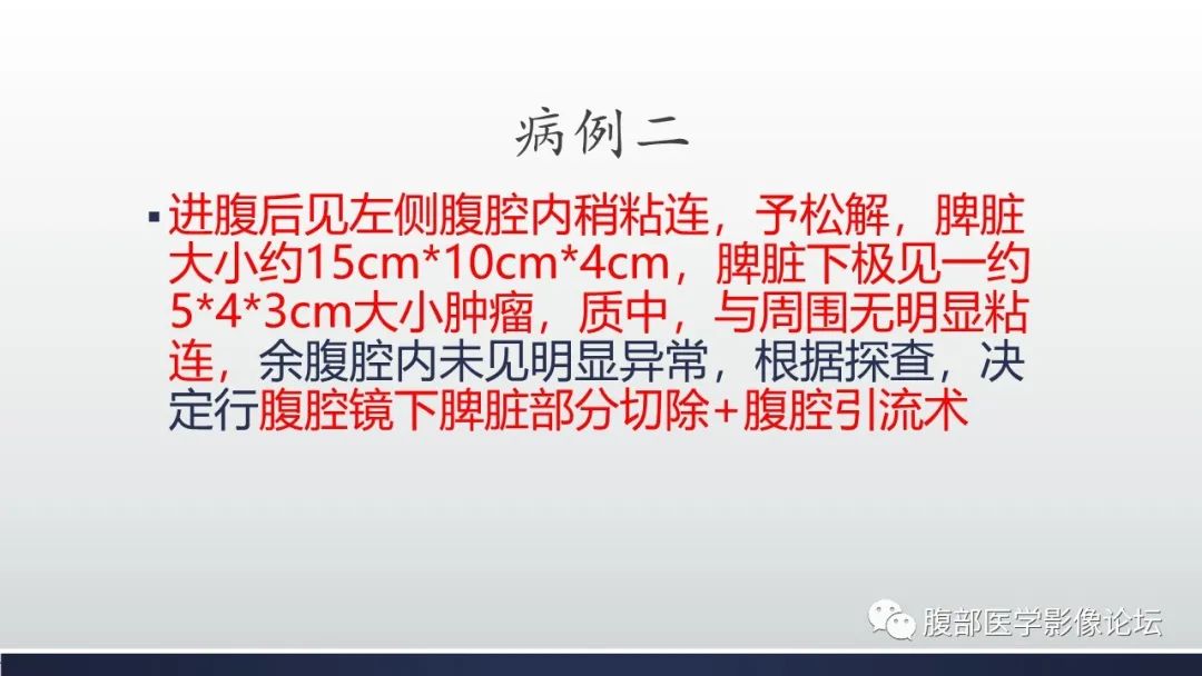 影像PPT - 【病例】脾脏窦岸细胞血管瘤2例影像诊断-20