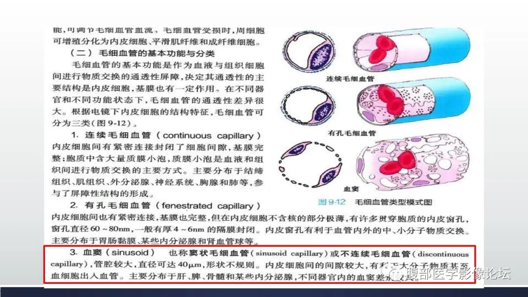 影像PPT - 【病例】脾脏窦岸细胞血管瘤2例影像诊断-23