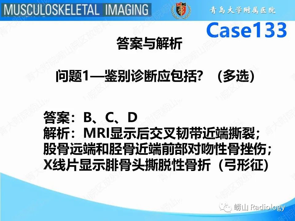 影像PPT - 【PPT】后交叉韧带撕裂-5