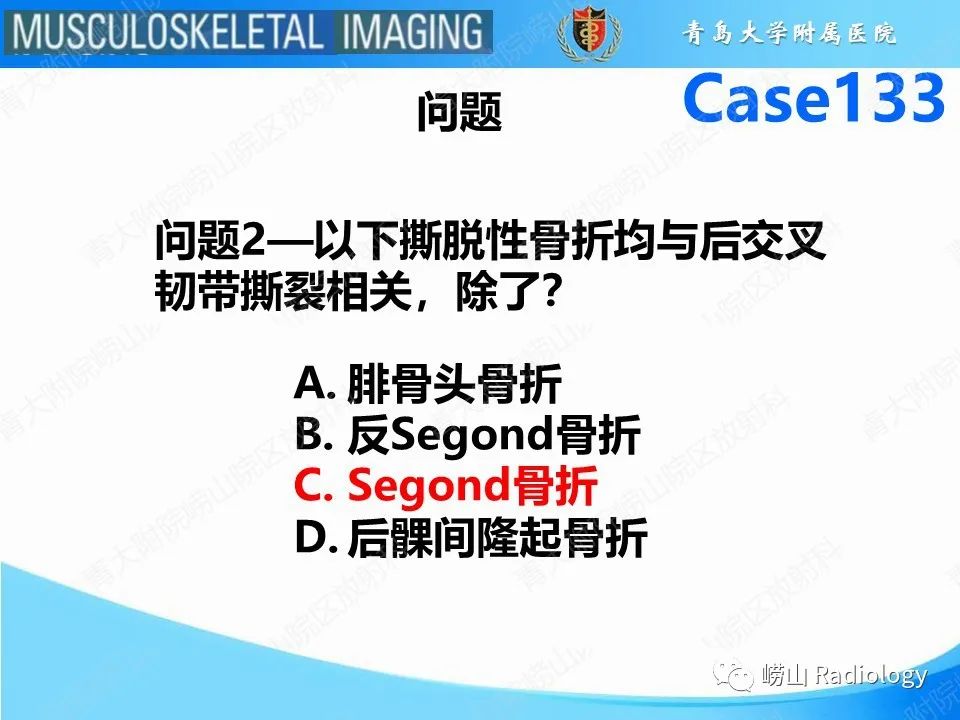 影像PPT - 【PPT】后交叉韧带撕裂-16