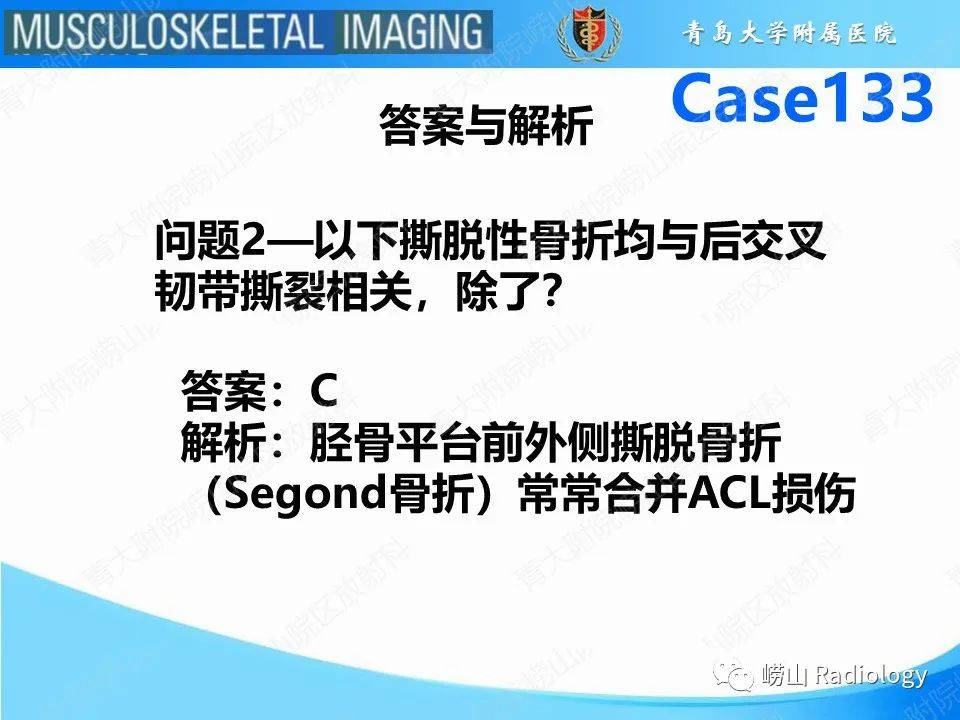 影像PPT - 【PPT】后交叉韧带撕裂-17