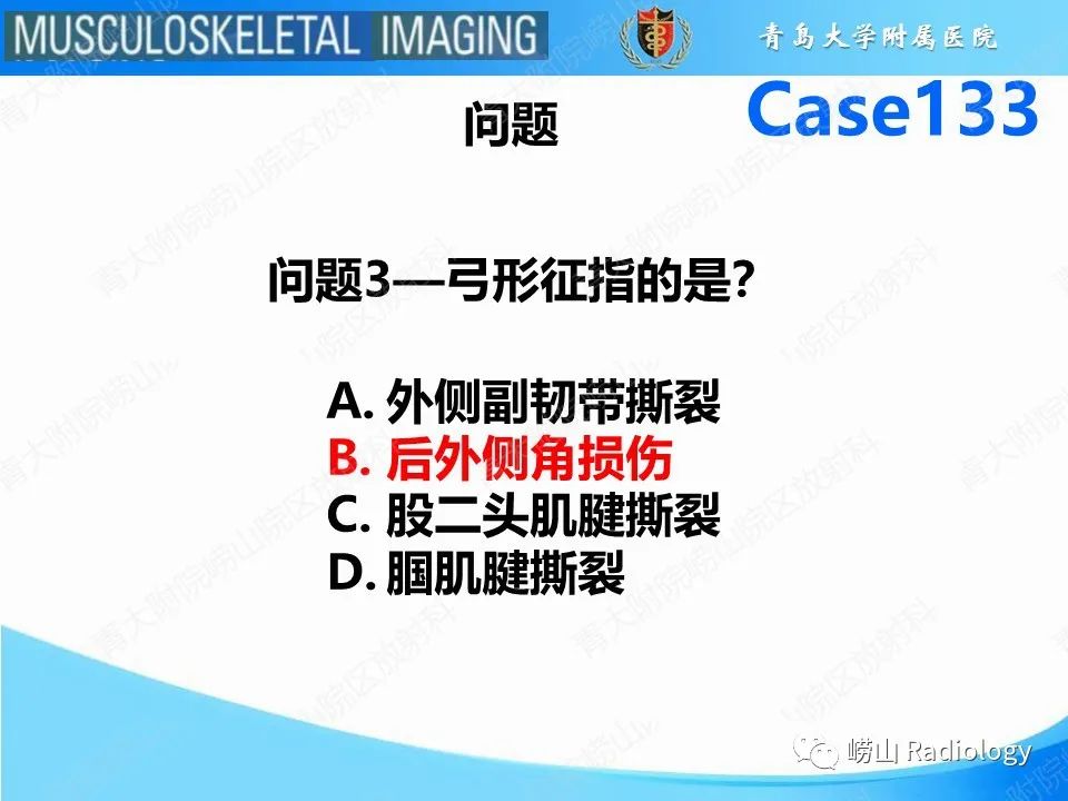 影像PPT - 【PPT】后交叉韧带撕裂-19