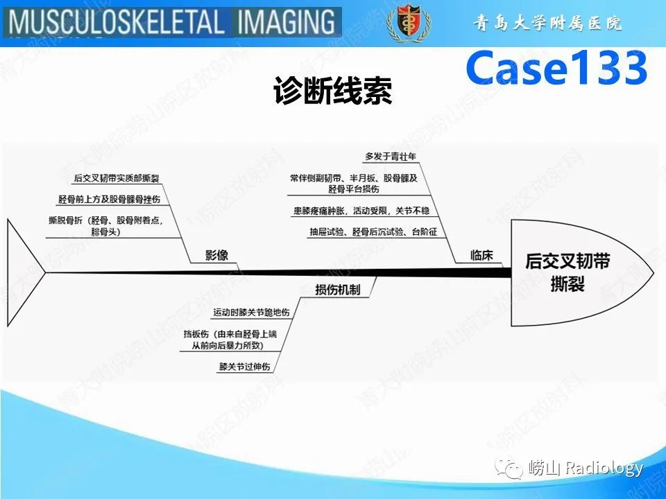 影像PPT - 【PPT】后交叉韧带撕裂-27