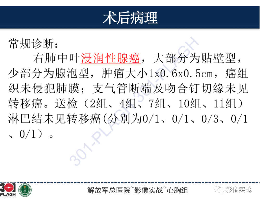 影像PPT - 【病例】肺浸润性腺癌1例CT-12