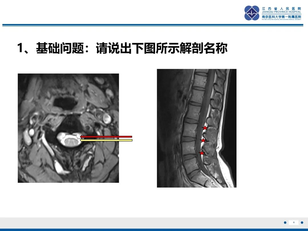 影像PPT - 【PPT】低颅压综合征-7