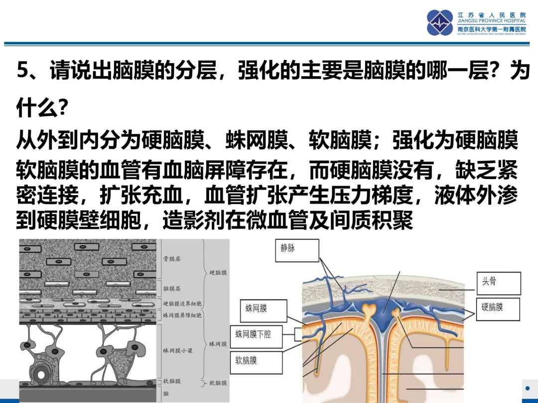 影像PPT - 【PPT】低颅压综合征-31