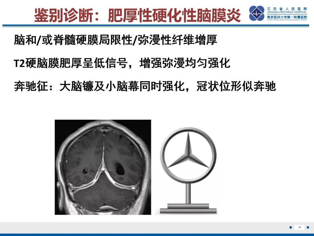 影像PPT - 【PPT】低颅压综合征-36