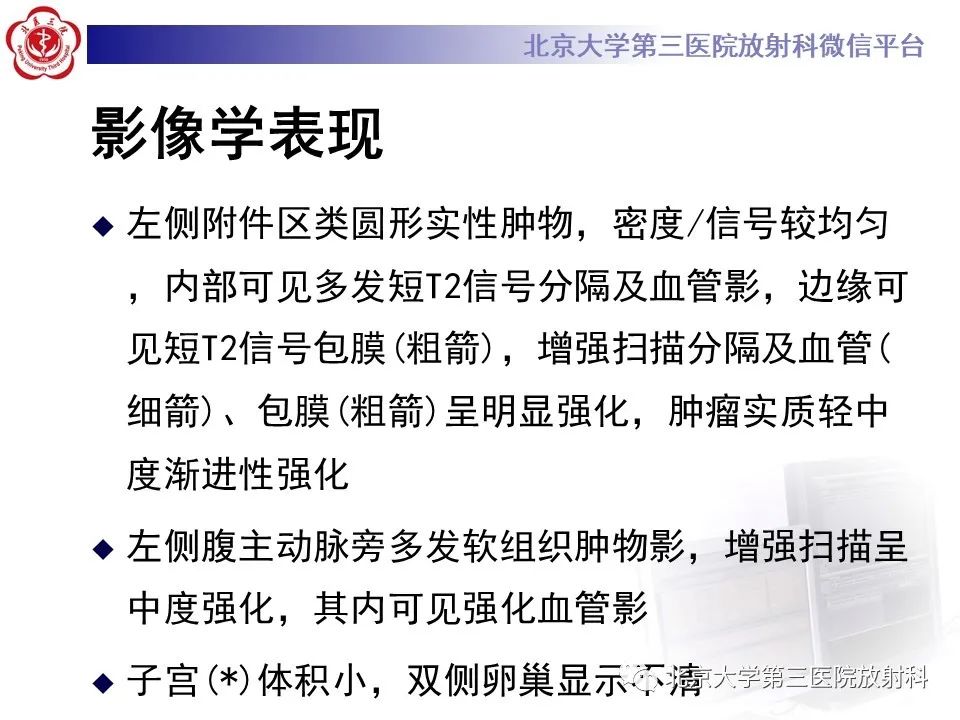 影像PPT - 【PPT】卵巢无性细胞瘤-8