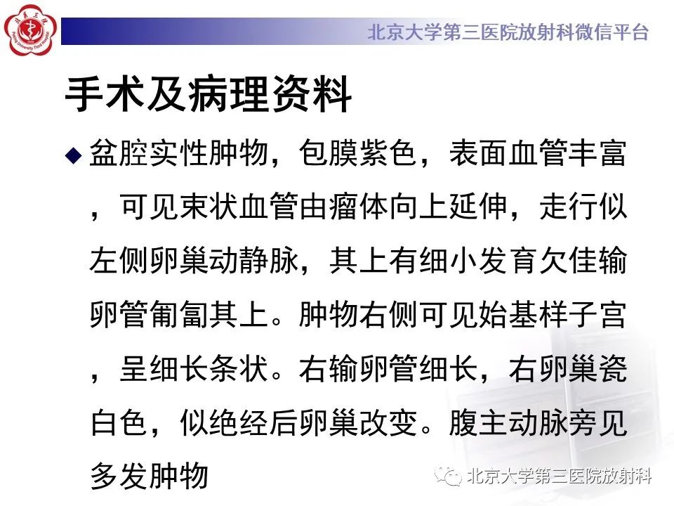 影像PPT - 【PPT】卵巢无性细胞瘤-10