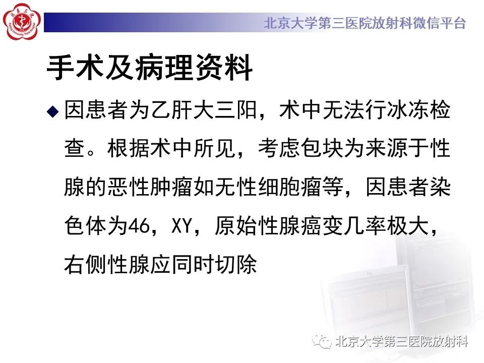 影像PPT - 【PPT】卵巢无性细胞瘤-11