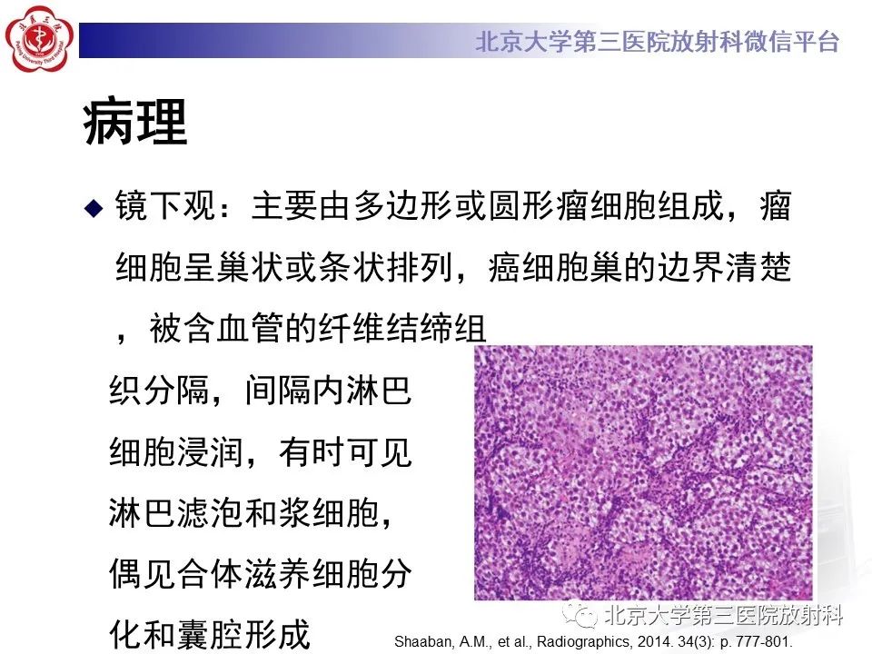 影像PPT - 【PPT】卵巢无性细胞瘤-18