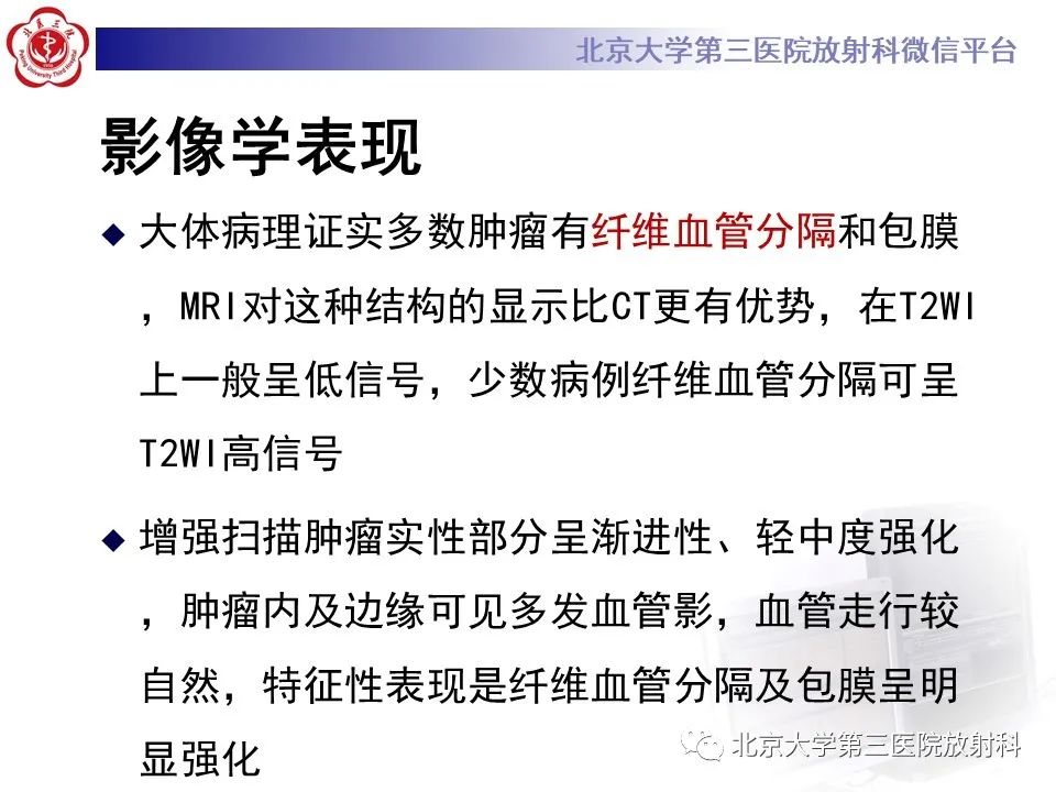 影像PPT - 【PPT】卵巢无性细胞瘤-21