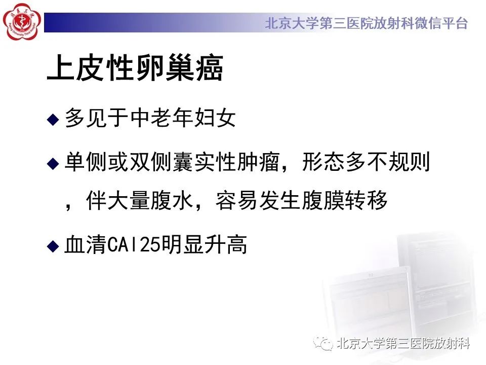 影像PPT - 【PPT】卵巢无性细胞瘤-30
