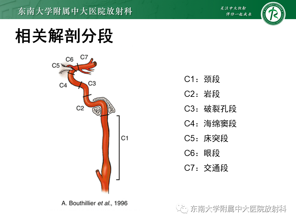 影像PPT - 【PPT】烟雾病-8