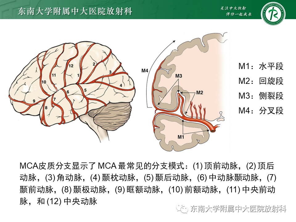 影像PPT - 【PPT】烟雾病-10