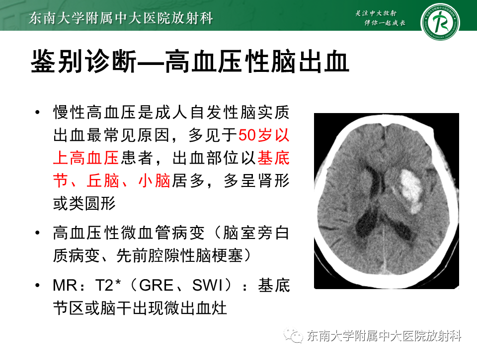 影像PPT - 【PPT】烟雾病-34
