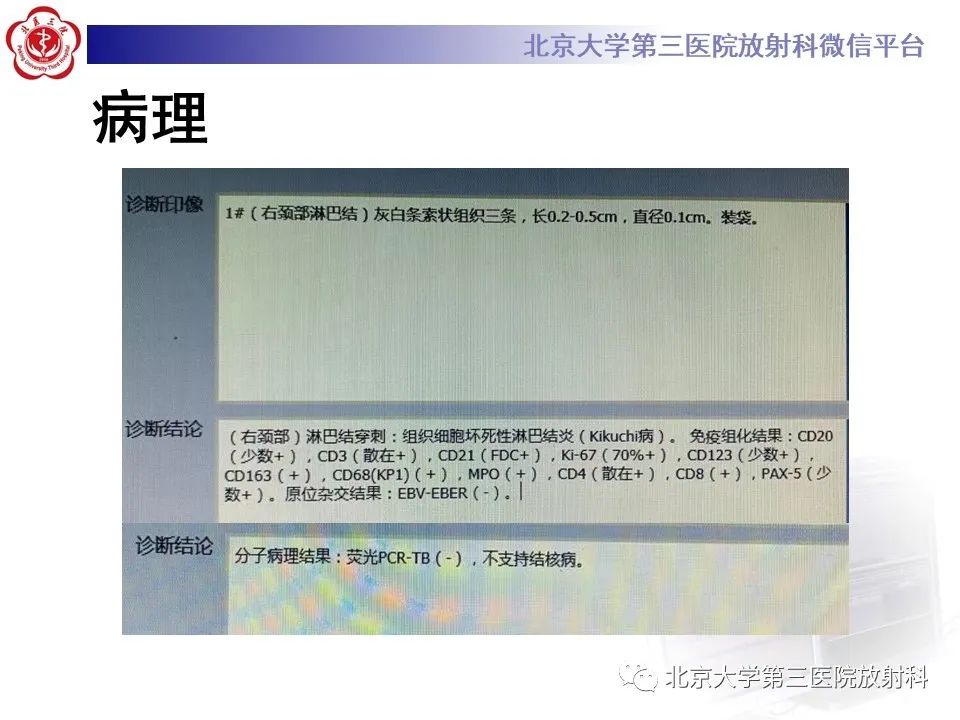 影像PPT - 【PPT】菊池病-6