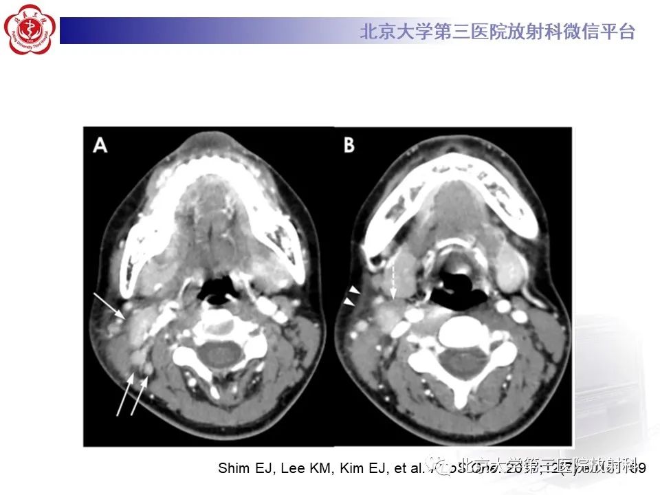 影像PPT - 【PPT】菊池病-16