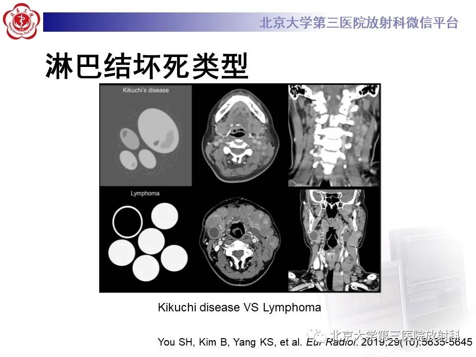 影像PPT - 【PPT】菊池病-30