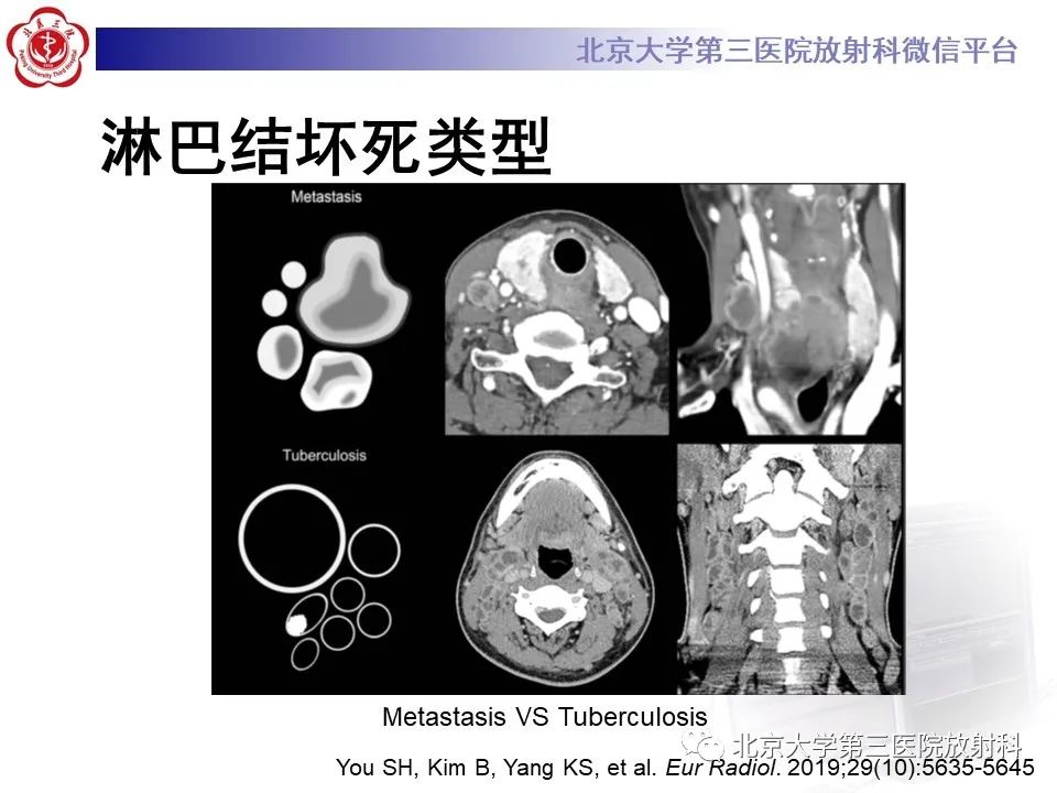 影像PPT - 【PPT】菊池病-31