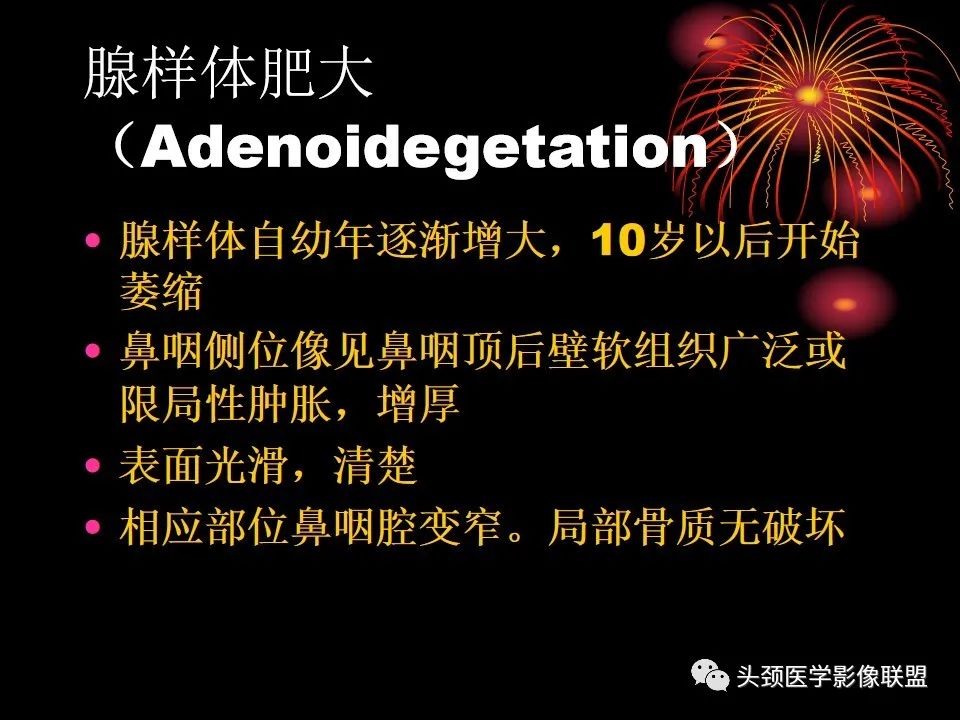 影像PPT - 【PPT】五官影像诊断学-60