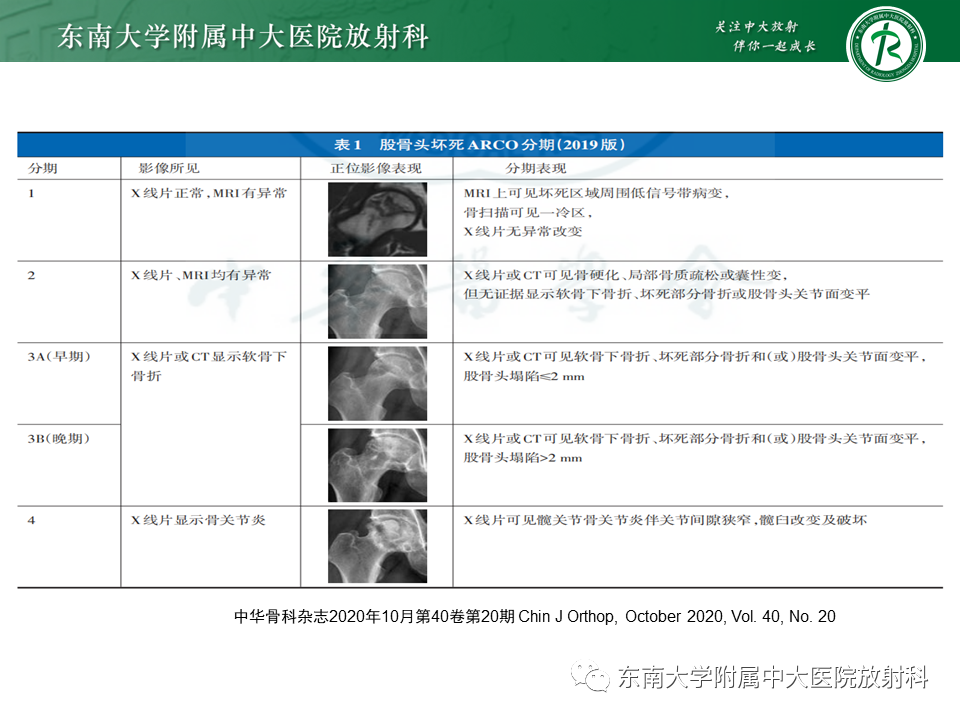 影像PPT - 【PPT】股骨头坏死-13