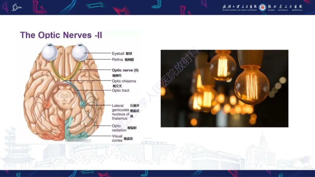 影像PPT - 【PPT】MRI在神经眼科疾病中的应用-9