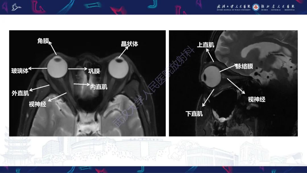 影像PPT - 【PPT】MRI在神经眼科疾病中的应用-11