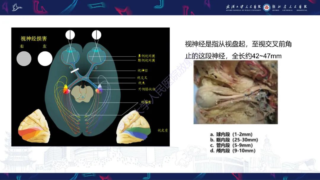 影像PPT - 【PPT】MRI在神经眼科疾病中的应用-8