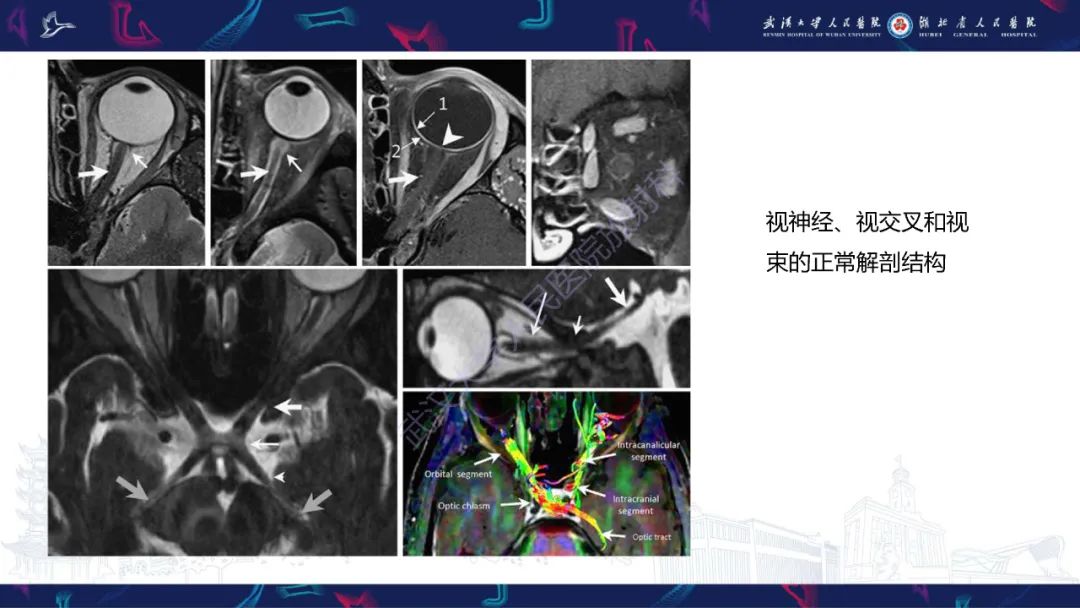 影像PPT - 【PPT】MRI在神经眼科疾病中的应用-10