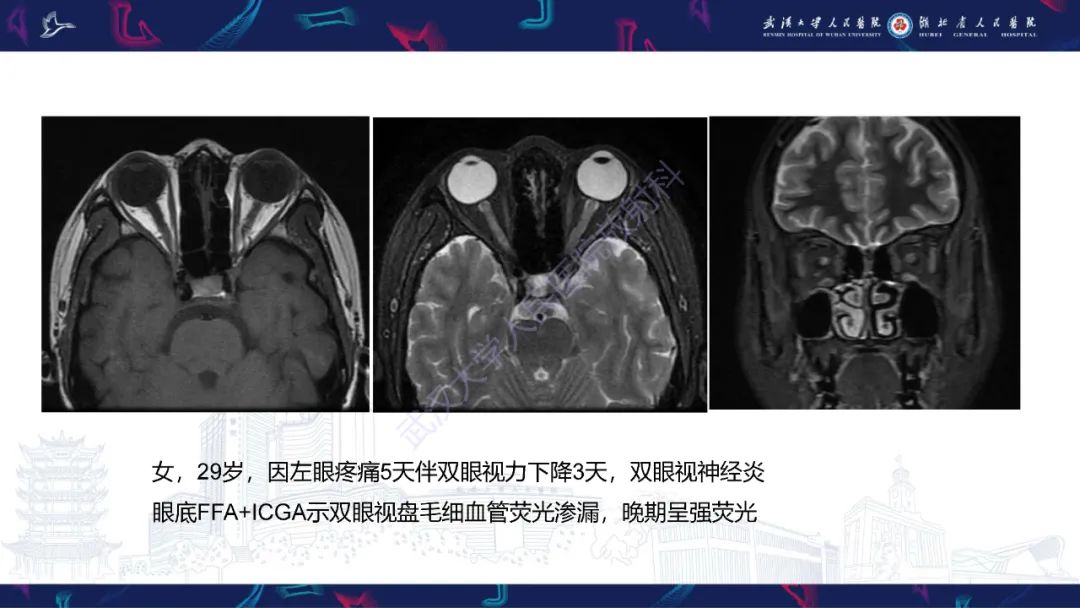 影像PPT - 【PPT】MRI在神经眼科疾病中的应用-14