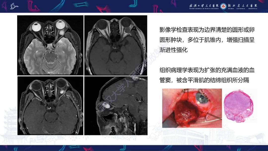 影像PPT - 【PPT】MRI在神经眼科疾病中的应用-51