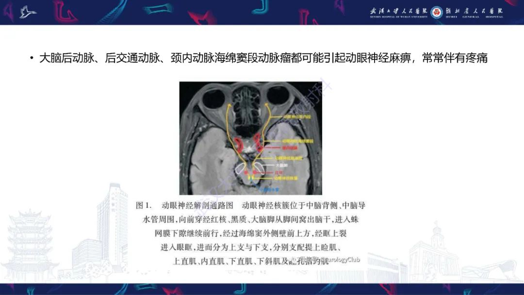 影像PPT - 【PPT】MRI在神经眼科疾病中的应用-56