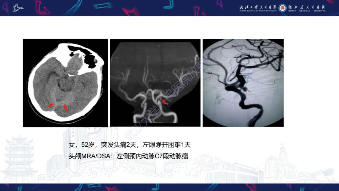 影像PPT - 【PPT】MRI在神经眼科疾病中的应用-57
