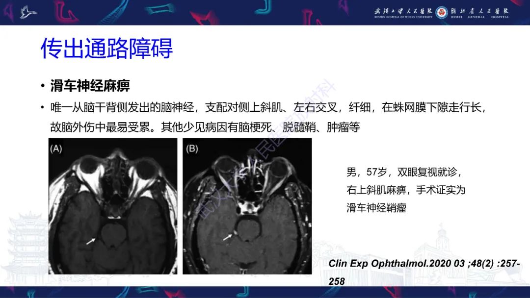 影像PPT - 【PPT】MRI在神经眼科疾病中的应用-62