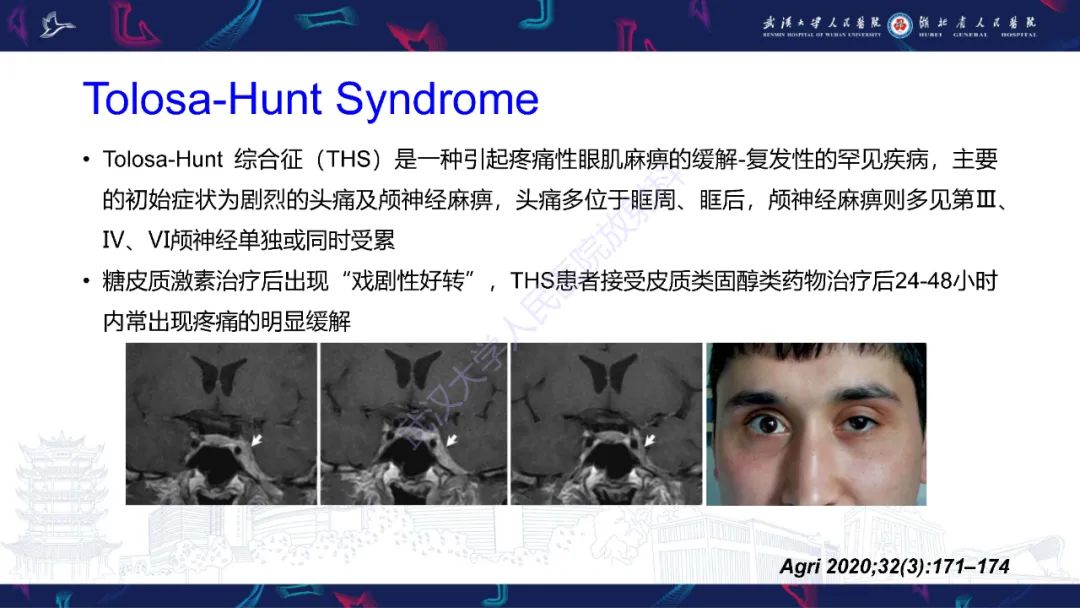 影像PPT - 【PPT】MRI在神经眼科疾病中的应用-69