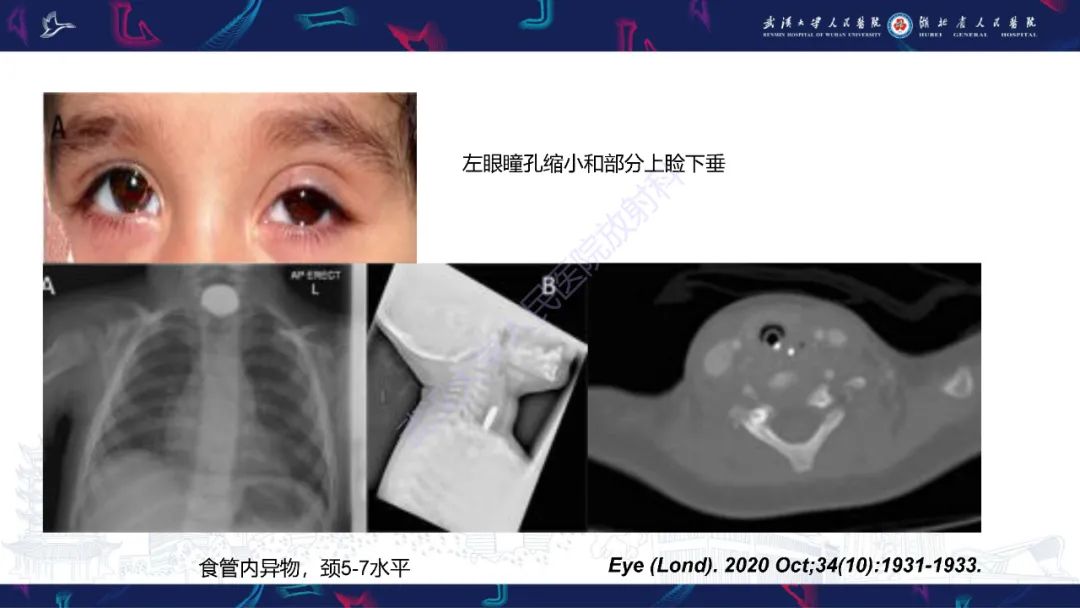 影像PPT - 【PPT】MRI在神经眼科疾病中的应用-74