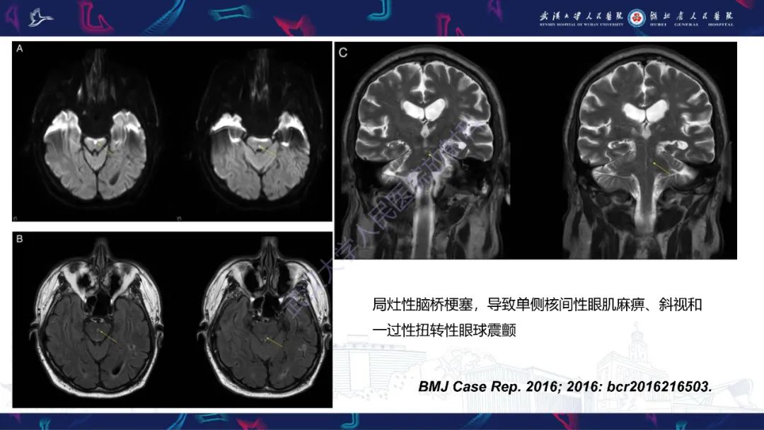 影像PPT - 【PPT】MRI在神经眼科疾病中的应用-77