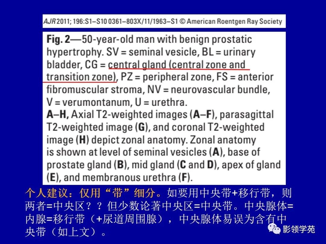 影像PPT - 【PPT】前列腺癌MRI诊断再认识-28